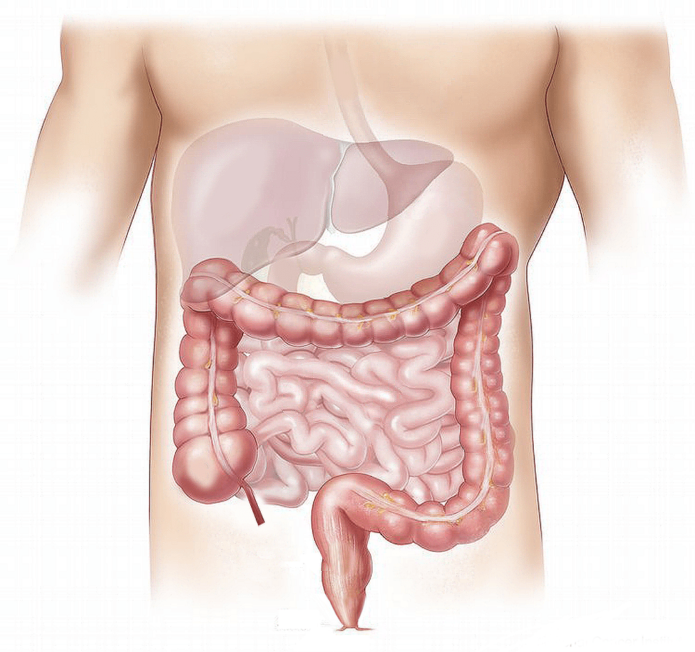 LOW FODMAP – DWUFAZOWA DIETA ŁAGODZĄCA OBJAWY IBS